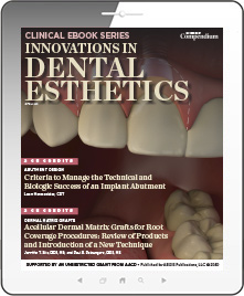 Innovations in Dental Esthetics Ebook Cover