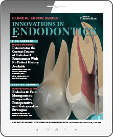 Innovations in Endodontics Ebook Cover