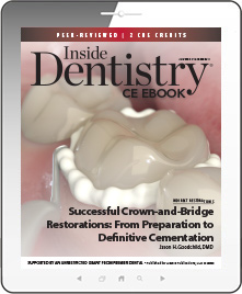 Successful Crown-and-Bridge Restorations: From Preparation to Definitive Cementation Ebook Cover