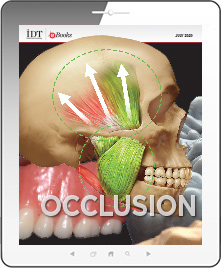 Occlusion Ebook Cover