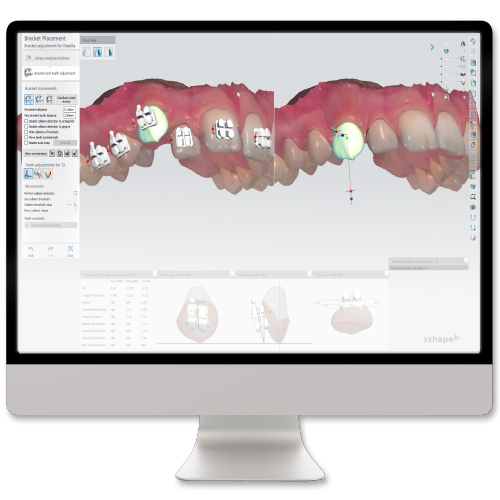 Taking Digital Orthodontics to the Next Level Ebook Library Image