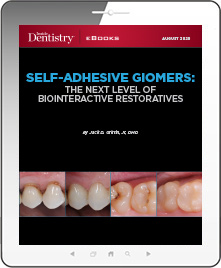Self-Adhesive Giomers: The Next Level of Biointeractive Restoratives Ebook Cover