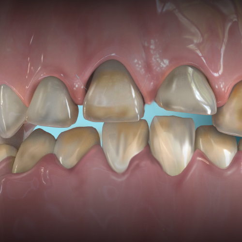 Advancements in Restorative Dentistry Ebook Library Image