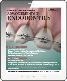 Advancements in Endodontics Ebook Cover