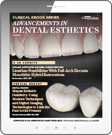 Advancements in Dental Esthetics Ebook Cover