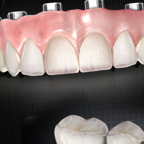 Advancements in Dental Esthetics Ebook Library Image