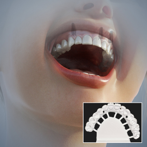 Advancements in Prosthodontics Ebook Library Image