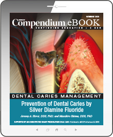 Prevention of Dental Caries by Silver Diamine Fluoride Ebook Cover