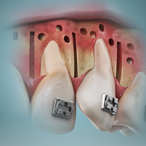 Advancements in Orthodontics Ebook Library Image
