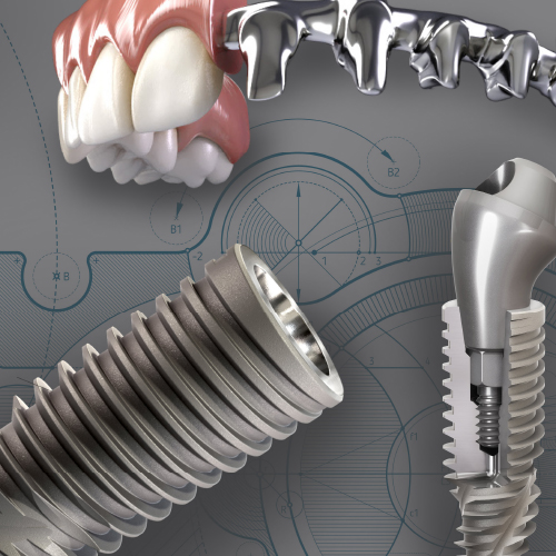 Grand Design: Implant and Full-Arch Solutions for Strength and Stability Ebook Library Image