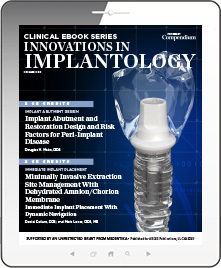 Innovations in Implantology Ebook Cover