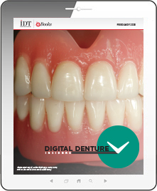 Digital Denture Insiders Ebook Cover