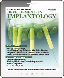 Developments in Implantology Ebook Cover