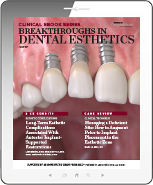 Breakthroughs in Dental Esthetics Ebook Cover