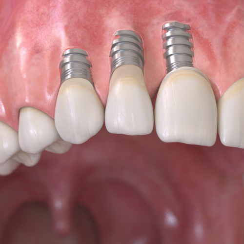 Breakthroughs in Dental Esthetics Ebook Library Image