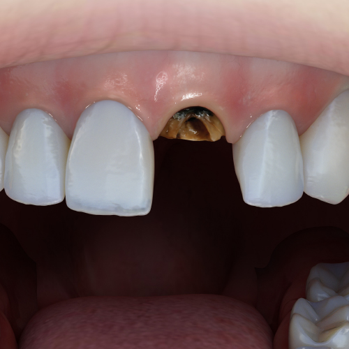 Breakthroughs in Endodontics Ebook Library Image