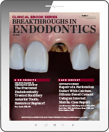 Breakthroughs in Endodontics Ebook Cover