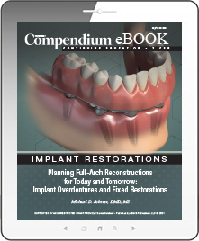 Planning Full-Arch Reconstructions for Today and Tomorrow: Implant Overdentures and Fixed Restorations Ebook Cover