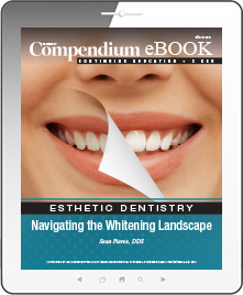 Navigating the Whitening Landscape Ebook Cover