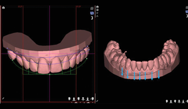 Facially Driven Interdisciplinary Integrated Digital Orthodontics