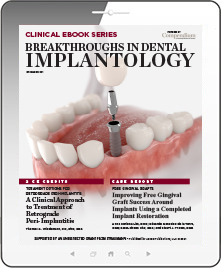 Breakthroughs in Dental Implantology Ebook Cover