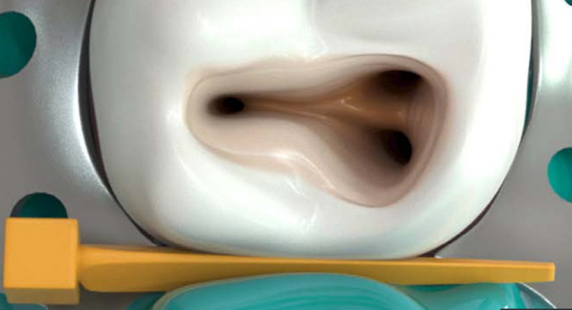 Steps to Endodontic Success for the General Practice