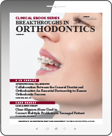 Breakthroughs In Orthodontics Ebook Cover