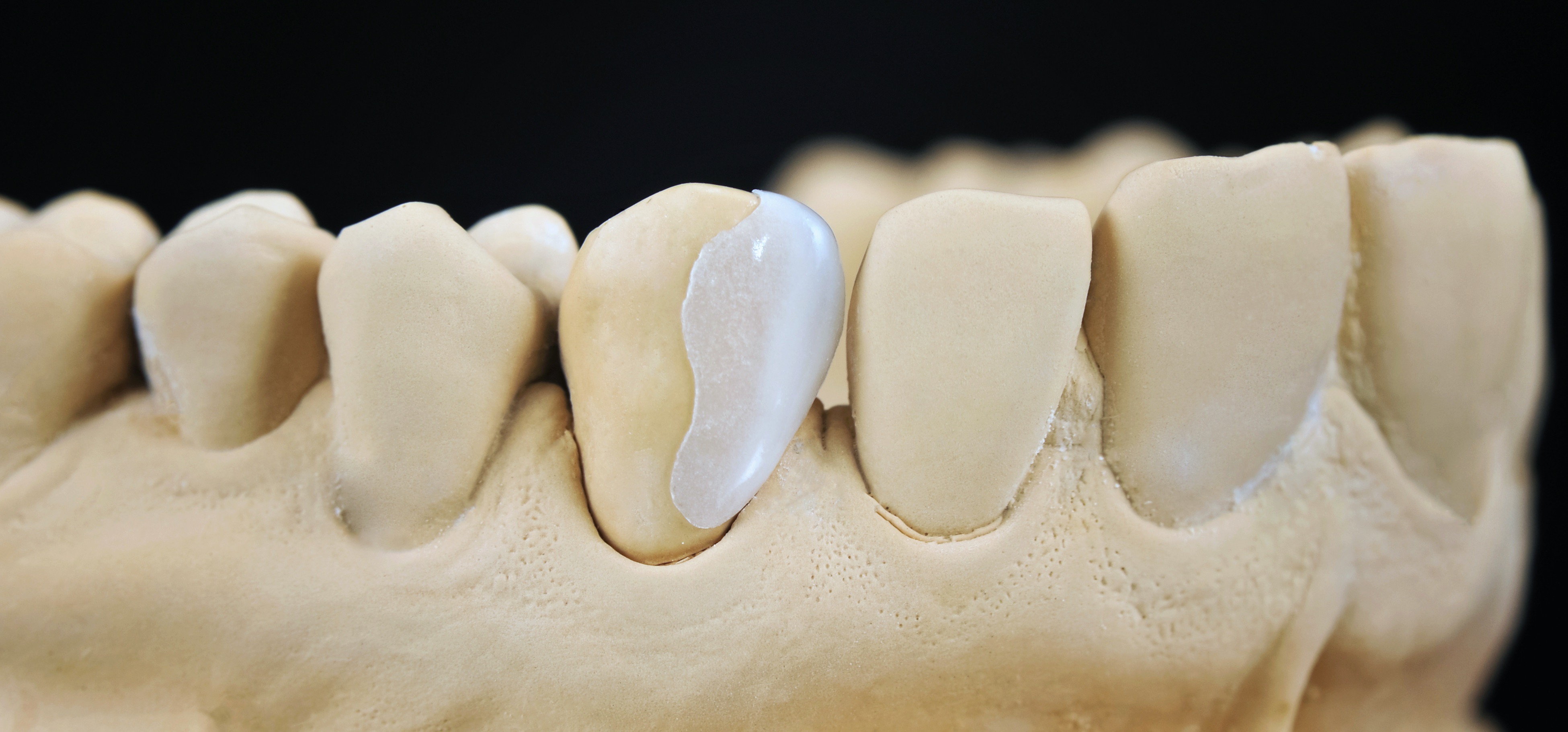 Updates in Restorative Dentistry