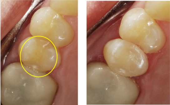 The “Universal” Trend in Dentistry for a Simplified and Systematic Practice