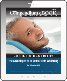 The Advantages of In-Office Teeth Whitening Ebook Cover