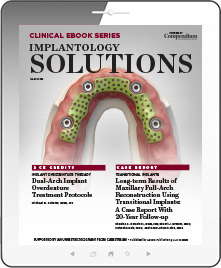 Implantology Solutions Ebook Cover