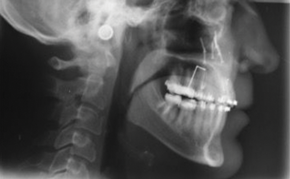 Guidelines for Orthodontic Evaluation and Preparation for Orthognathic Surgery Patients: Part 2