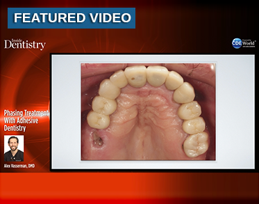 Phasing Treatment With Adhesive Dentistry