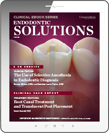 Endodontic Solutions Ebook Cover