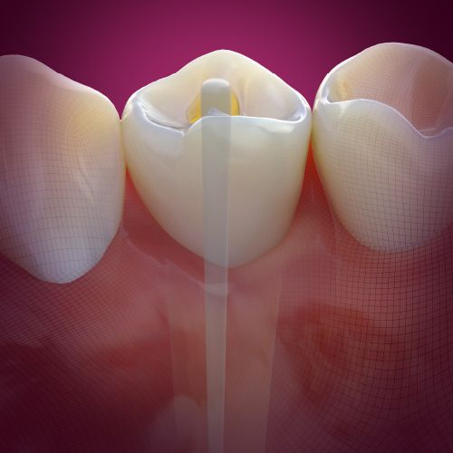Endodontic Solutions Ebook Library Image