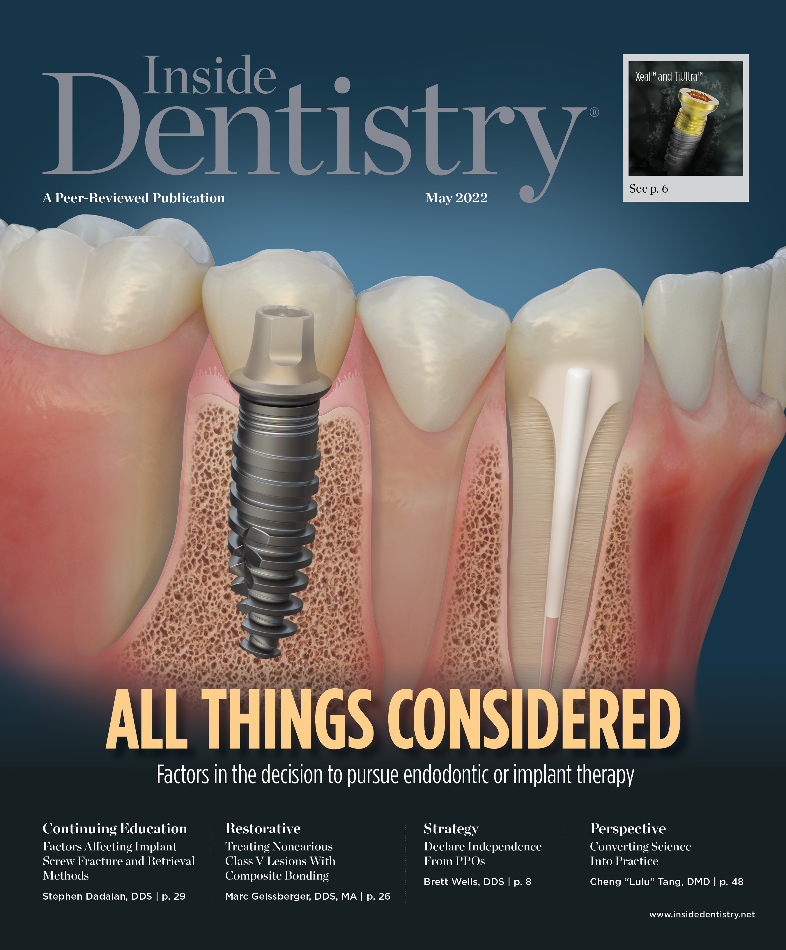 Inside Dentistry May 2022 Cover