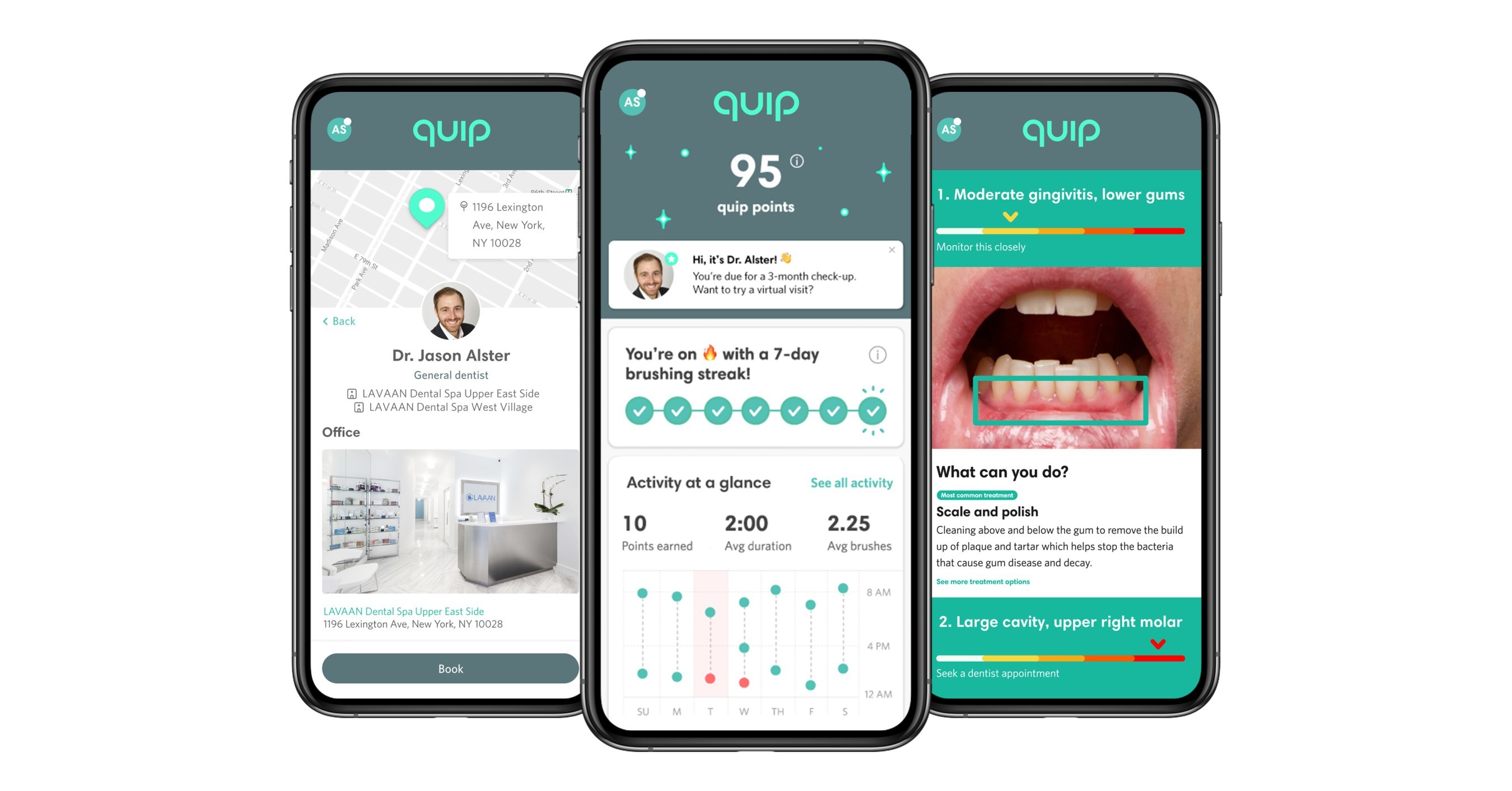 quip Acquires Teledentistry Company Toothpic to First 360degree