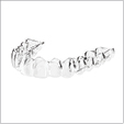 SureSmile® Aligners Boost Clinician’s Confidence in Recommending Clear Aligner Therapy to Patients
