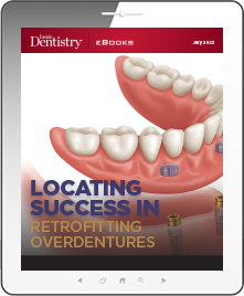 Locating Success in Retrofitting Overdentures Ebook Cover