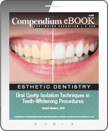 Oral Cavity Isolation Techniques in Teeth-Whitening Procedures Ebook Cover