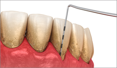 Periodontitis and Systemic Health: Emerging Trends in Diagnosis and Treatment