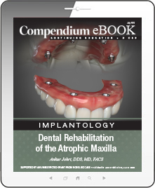 Dental Rehabilitation  of the Atrophic Maxilla Ebook Cover