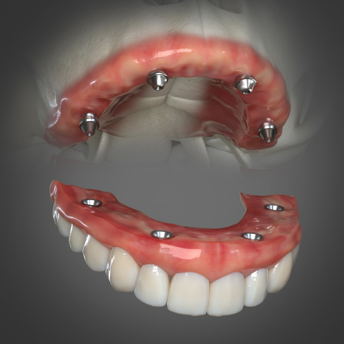 Dental Rehabilitation  of the Atrophic Maxilla Ebook Library Image
