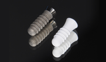 Ceramic Dental Implants: An Overview of Materials, Characteristics, and Application Concepts