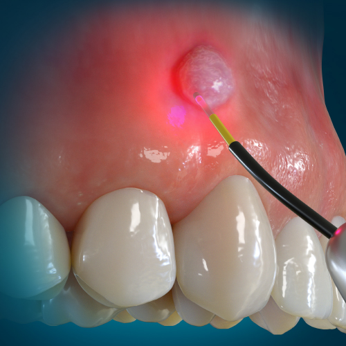 Oral Surgery Advances Ebook Library Image