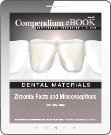 Zirconia: Facts and Misconceptions Ebook Cover