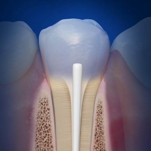 Endodontic Advances Ebook Library Image