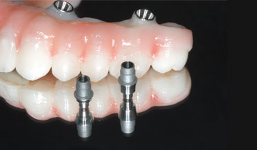 The Dental Lab – 3D AOX