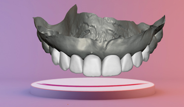 Digital Smile Design and Fabrication of CAD/CAM Restorations in a Complex Esthetic Case