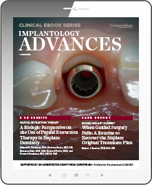 Implantology Advances Ebook Cover
